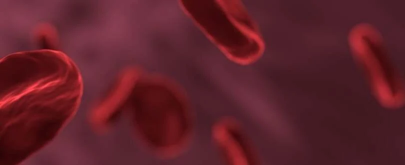 Coagulazione intravascolare disseminata (CID). Sintomi, terapie