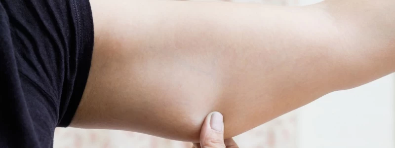 sono gonfia e piena di liquidi Le braccia gonfie